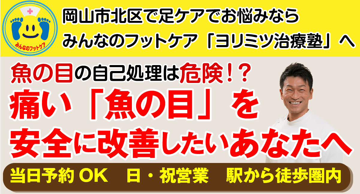 魚の目でお悩みのあなたへ