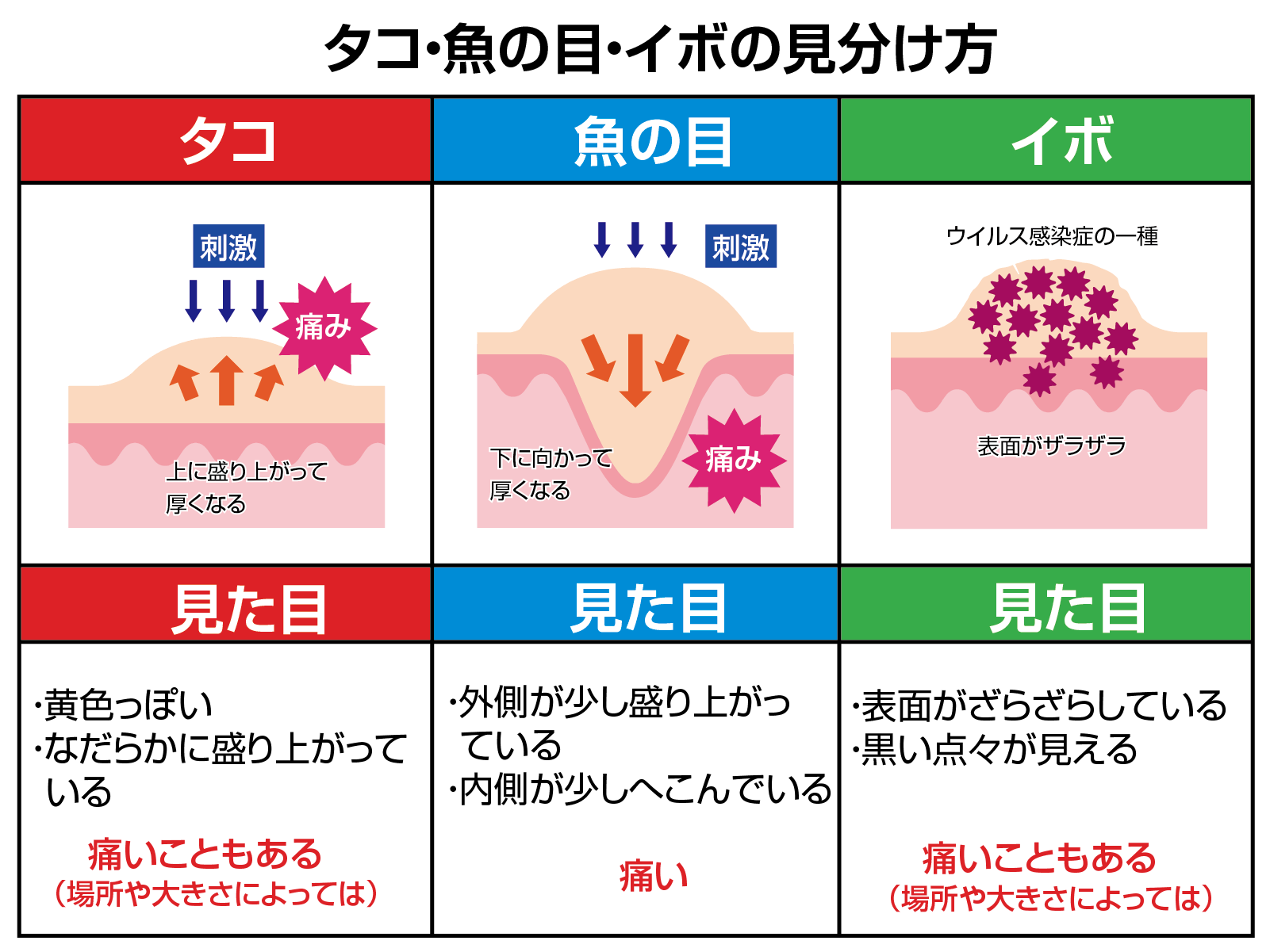 タコ・魚の目・イボの見分け方