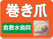 巻き爪倉敷水島院